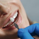 Dental Implants in Garland