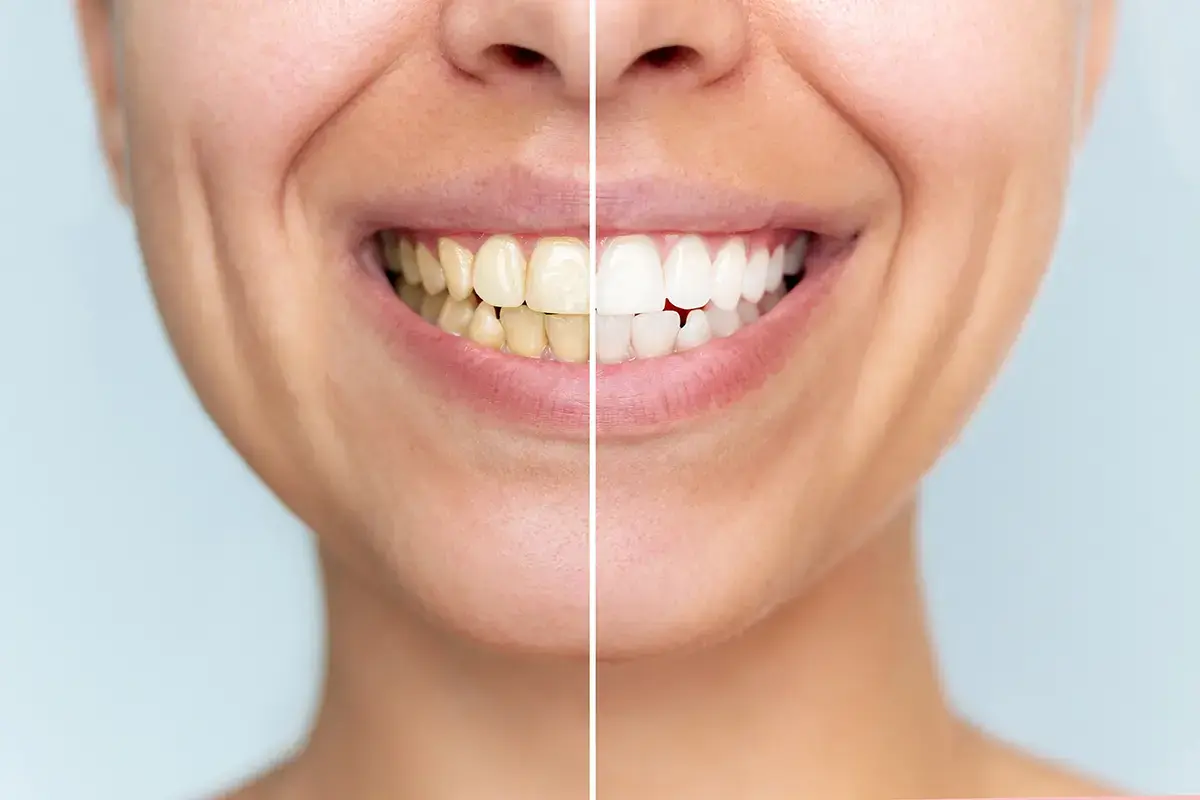 Best Makeover Smile Dental Clinic Near Me