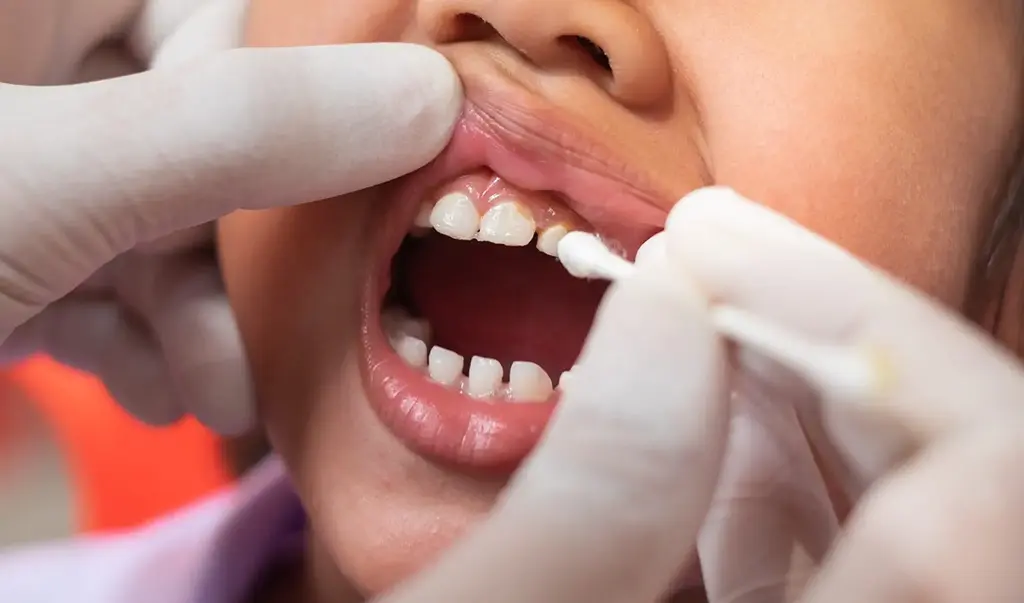 Childrens Dentist Garland