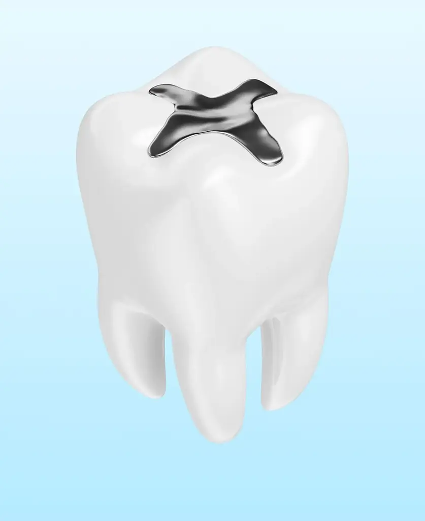 Cost of Dental Fillings In Plano