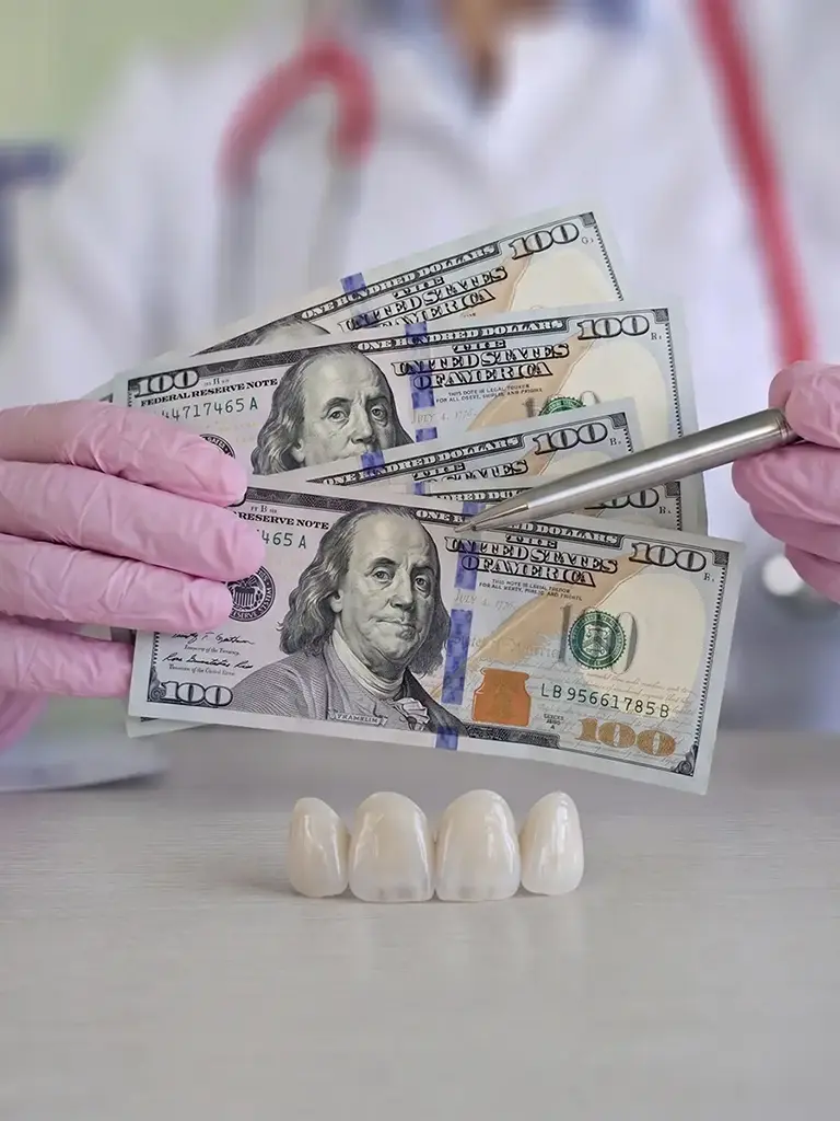 Cost of Veneers In Plano