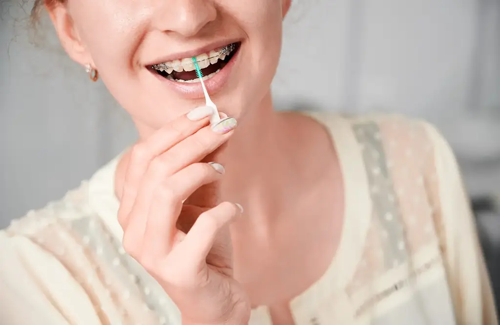 Metal Braces for Teens and Adults In Plano