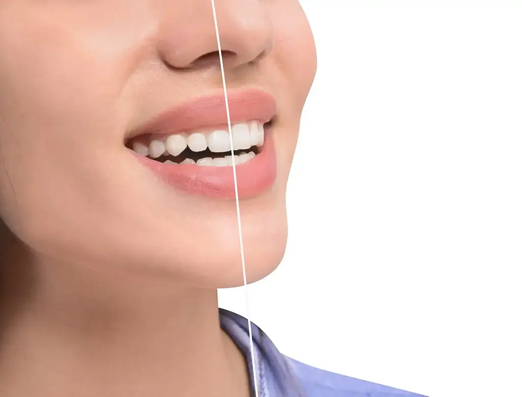 Cost of Laser Gum Contouring In Garland