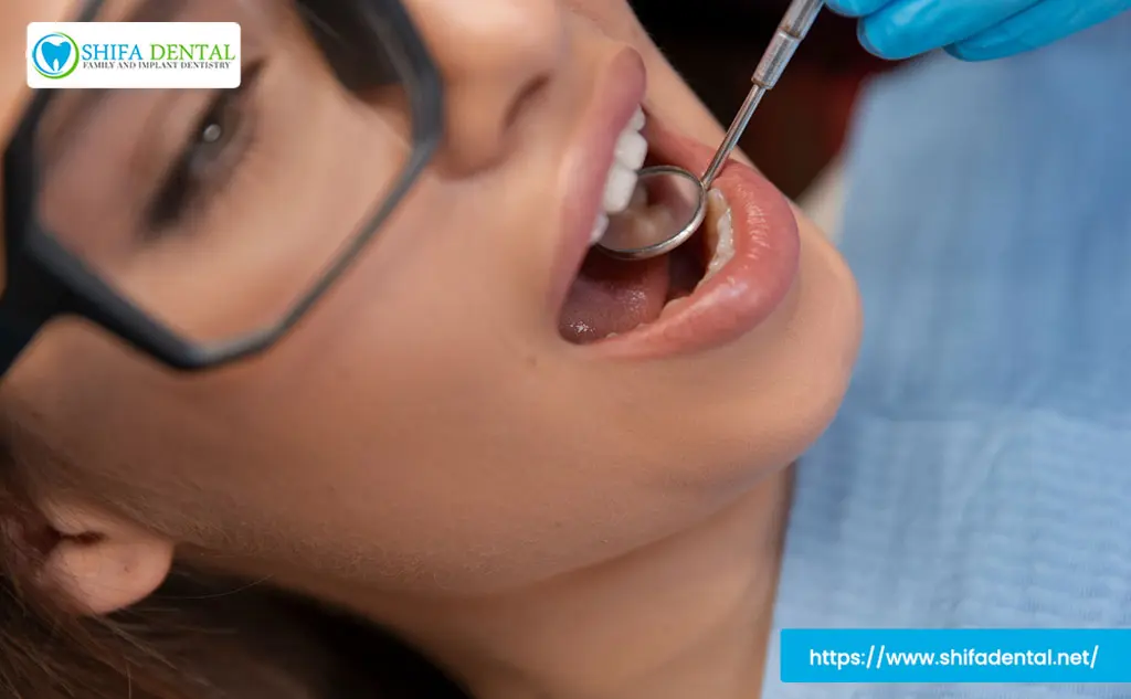 Teeth Filling Charges