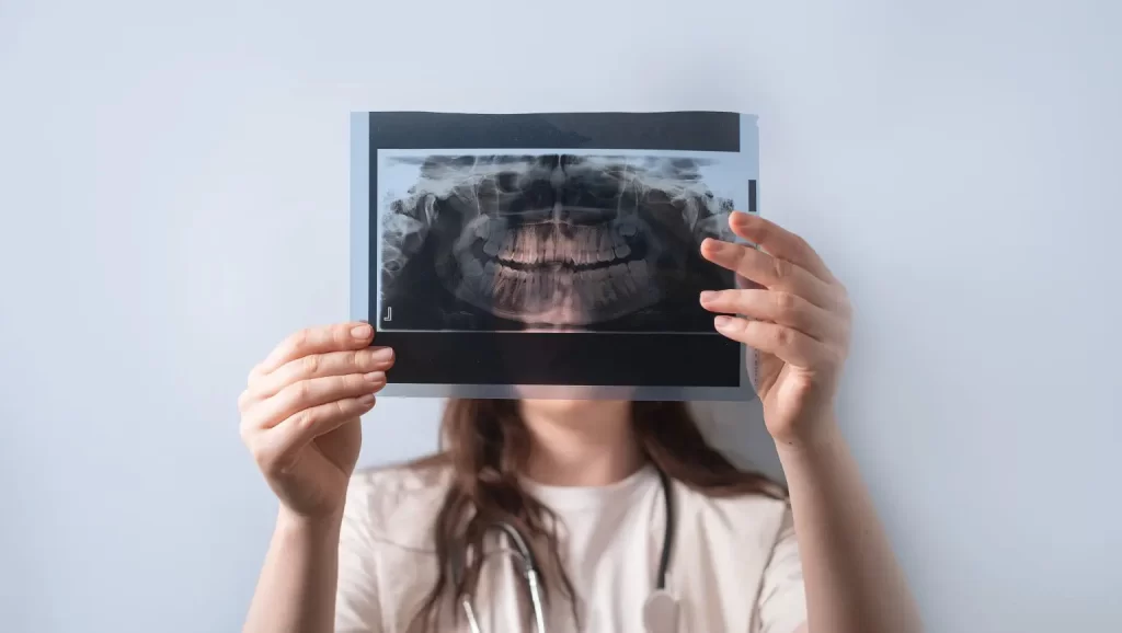 Dental X Rays