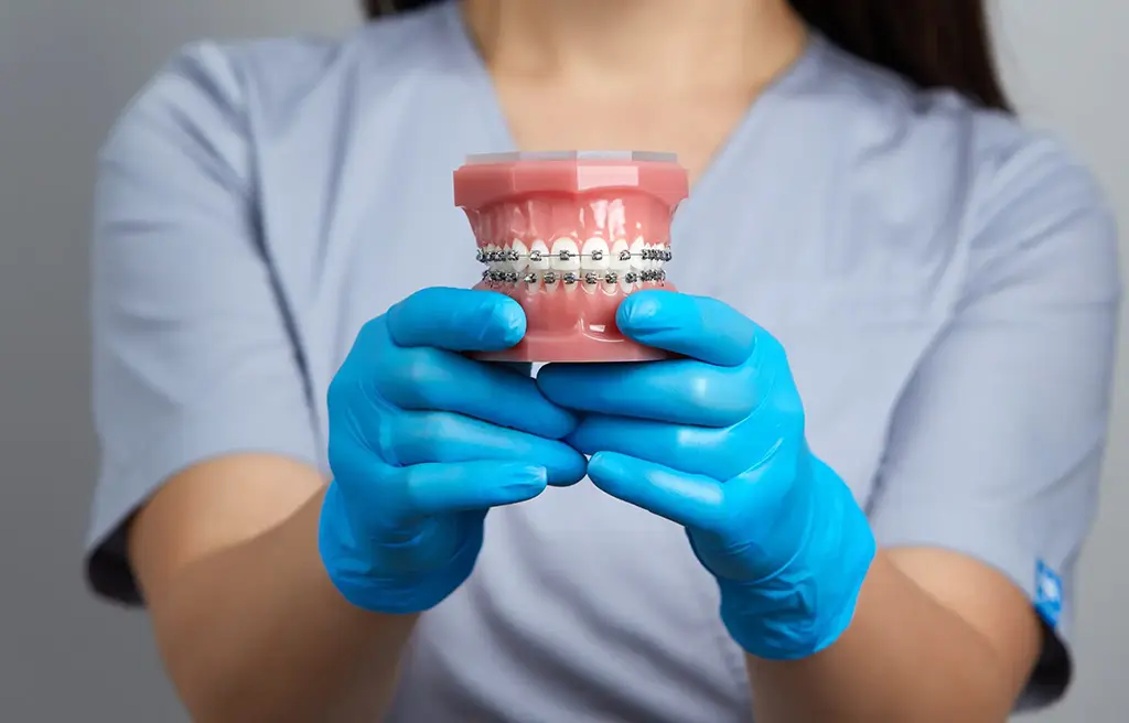 Dental Metal Bracket