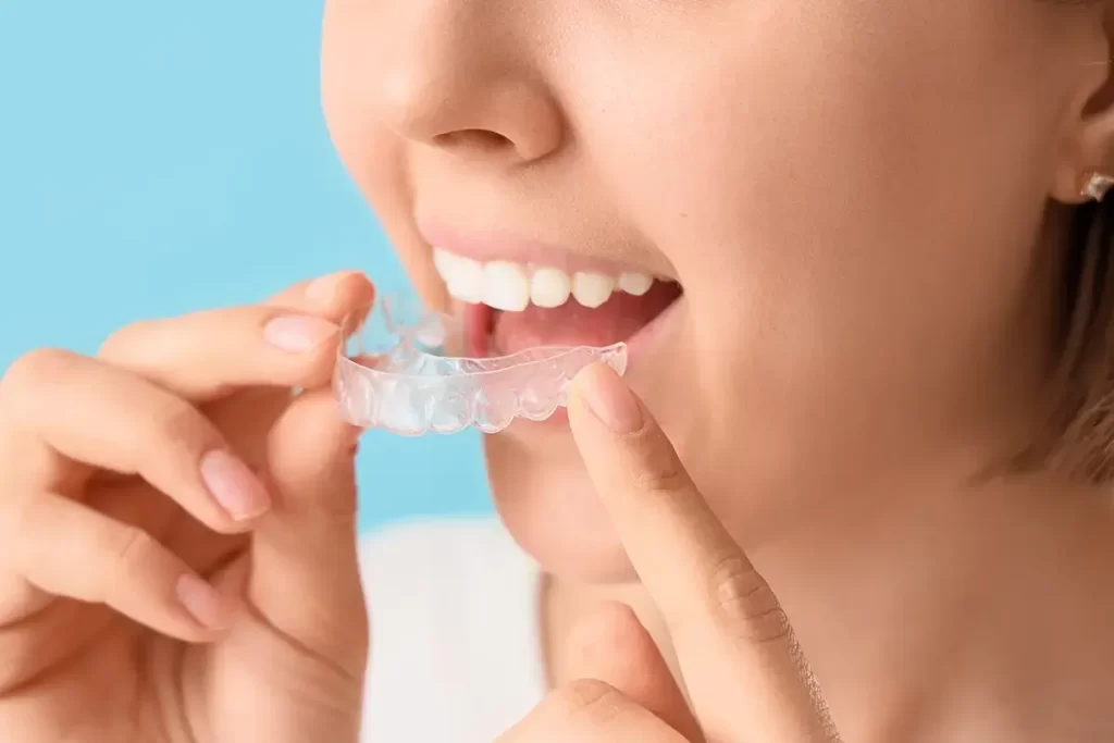 Dental Night Guard