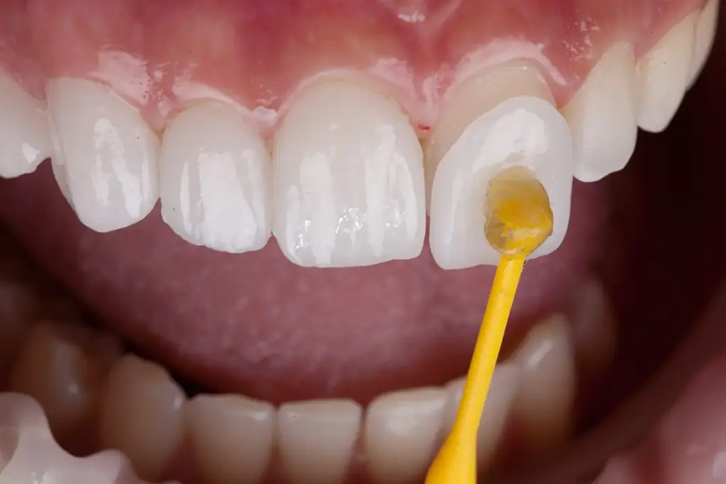 Cosmetic Dentistry In Plano