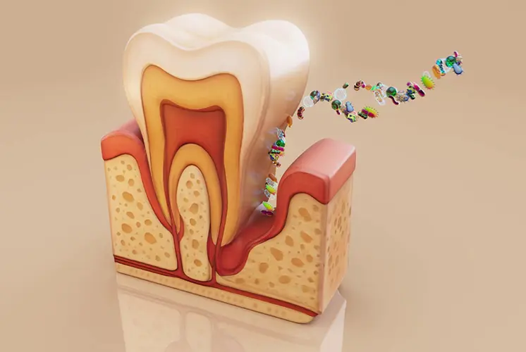 Affordable Periodontal Therapy
