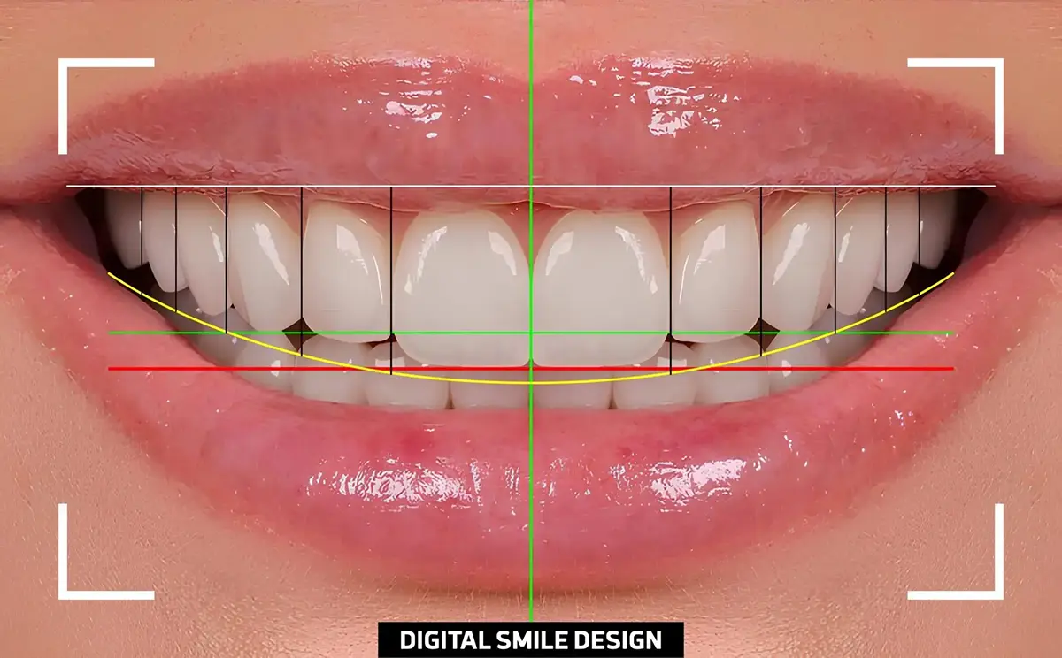 Affordable Smile Makeover