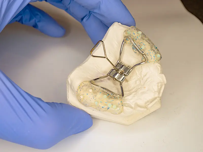 Dental Implant Retainer