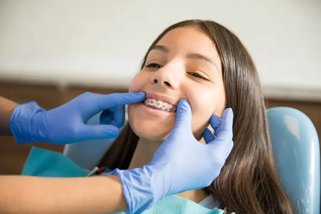Benefits of Steel Braces for Teeth