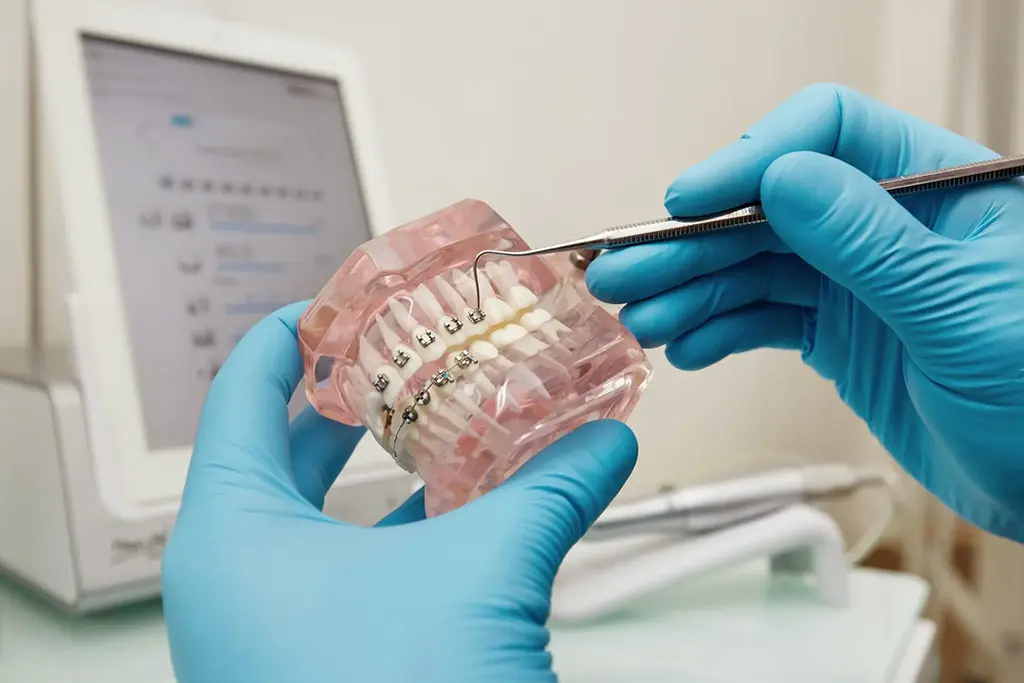 Traditional Metal Braces In Plano