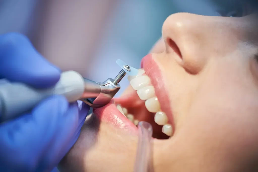 Affordable Same Day Teeth Cleaning