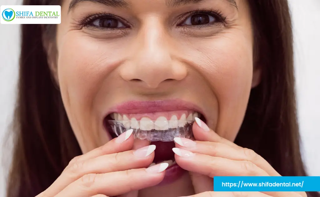 Dental Retainer