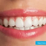 In Office Teeth Whitening in Garland