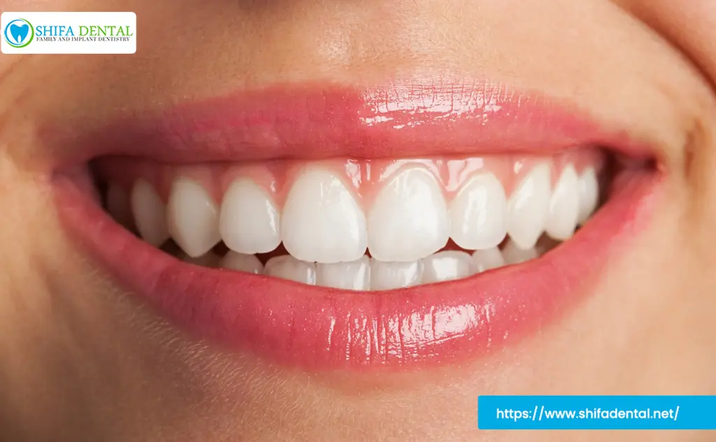 In Office Teeth Whitening in Garland