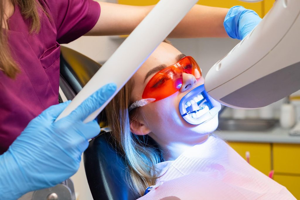 Cosmetic Teeth Whitening in Plano